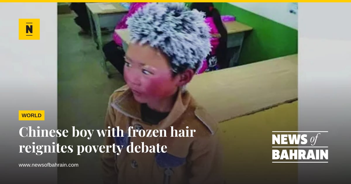 Overty Images Chinese boy with frozen hair reignites poverty debate | News of Bahrain